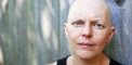 Cancer-Patient-Chemo-Chemotherapy-Hair-Treatment-Women
