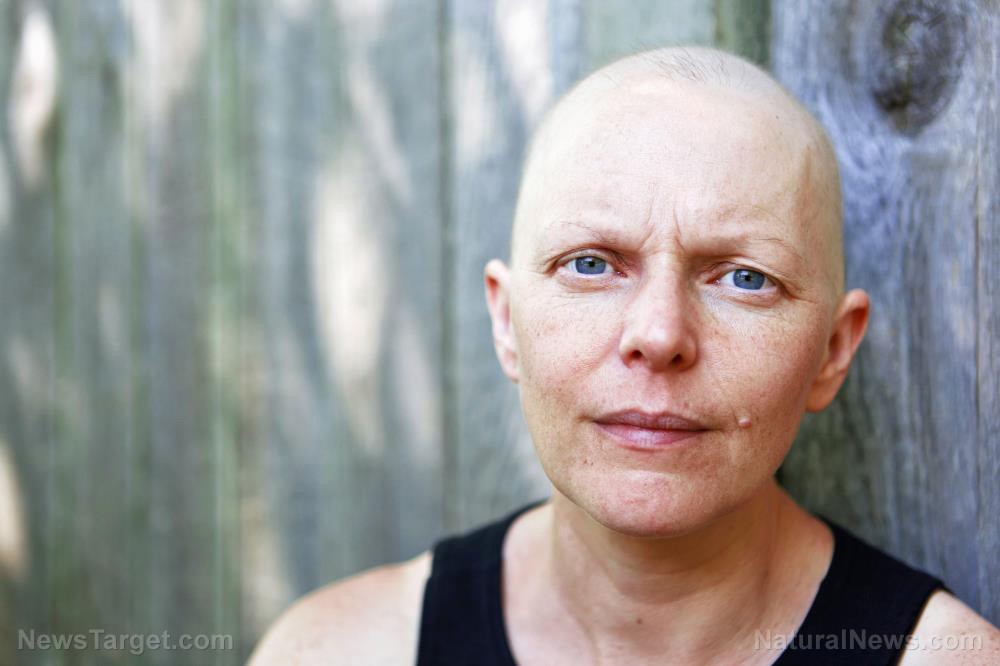 Cancer-Patient-Chemo-Chemotherapy-Hair-Treatment-Women